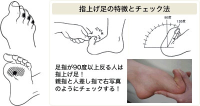 指上げ足の特徴とチェック法
